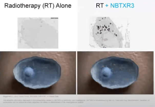 Slide from 2020 Webinar. Left shows tumor cell. Right shows tumor cell penetrated by NBTXR3